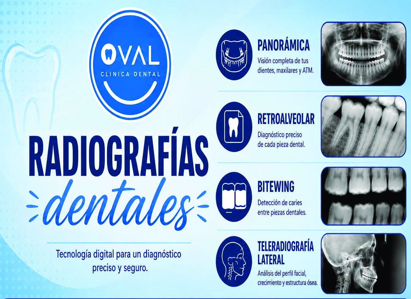 Promoción Oval Clínica Dental Viña del Mar